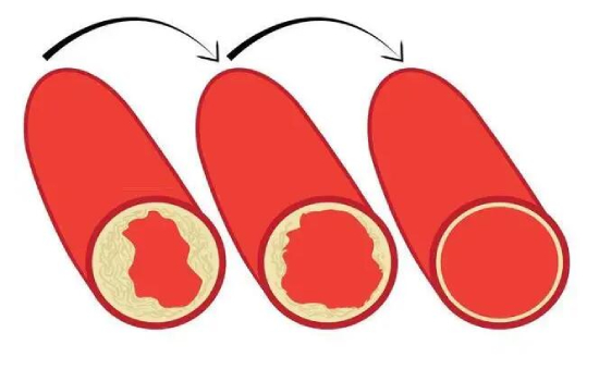 科悅：血管硬化的“照妖鏡”——動脈硬化檢測儀